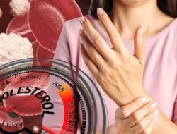 Waspada Konsumsi Makanan Kolesterol dan Kandungan Gula Tinggi saat Natal